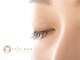 アイリスネオ(iris.neo)の写真/<目元のコンプレックス解消>下がりまつげや左右差などのお悩みに寄り添い最適なデザインをプロがご提案◎