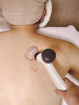 中医美容健康サロン 妙蓮/スライド背中・二の腕