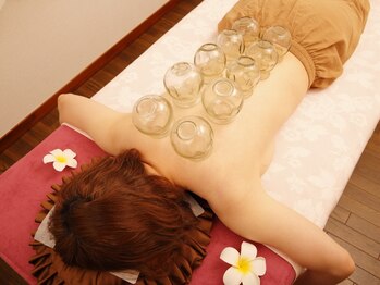 技道リラクゼーション/カッピング