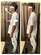 アイリー(Irie)/骨格矯正