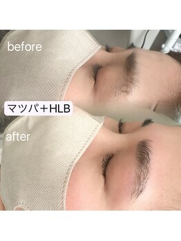 エクラ バイ シャンリィ(eclat by shanLy)/同時施術可能！