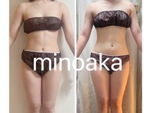 ヨサパーク ミノアカ(YOSA PARK MINOAKA)