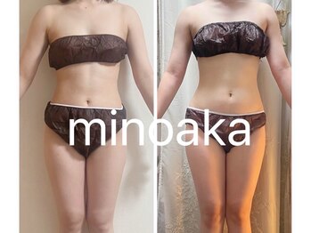 ヨサパーク ミノアカ(YOSA PARK MINOAKA)