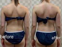 ハレオラ(HaleOla)/育乳マッサージ&ゼロジーの効果