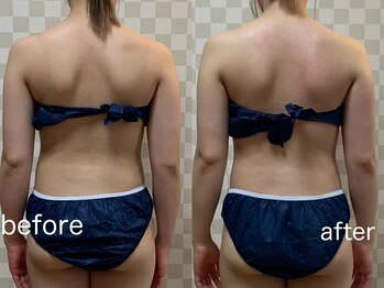 ハレオラ(HaleOla)/育乳マッサージ&ゼロジーの効果