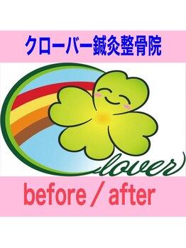 クローバー鍼灸整骨院/before→after