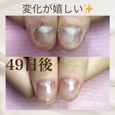 フロールフロール(Flor flor)