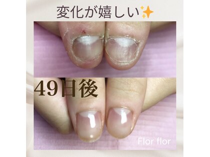 フロールフロール(Flor flor)の写真