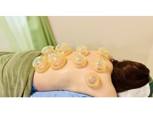 一二三鍼灸マッサージ治療院/【カッピング・筋膜リリース】