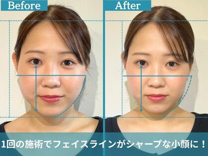 フローフシ∞の写真