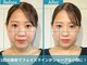 フローフシ∞の写真