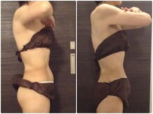 ウェリナ平和堂長久手院/小顔矯正/骨盤矯正/美脚サロン