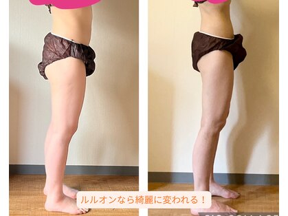 ヨサパーク ケリビオラ(YOSA PARK keli美ola)の写真