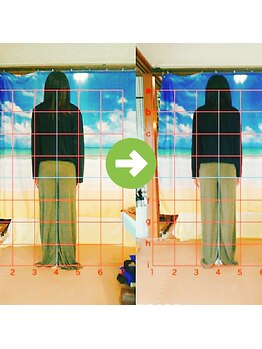 サプライズ整体院/20代ママの初回産後の骨盤矯正