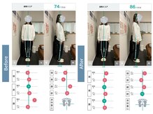 フィット 諫早院(Fit)/骨盤の歪み改善で首こりも楽に♪