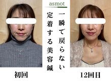 asmot鍼灸 整体院 代々木上原(asmot鍼灸 整体院)の雰囲気（【国家資格者】の小顔施術/美容鍼/代々木上原駅/リフトアップ）