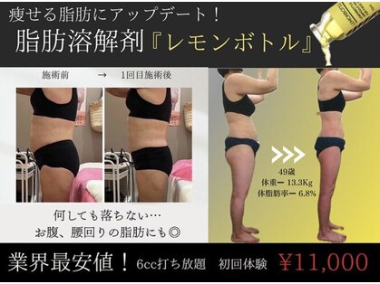 クリニカルエステ イーズ あべのキューズタウン店の写真