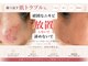 ビューティサロン アール(R)の写真