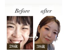 ディアンヌ(Diane)