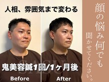サス(SASU)の雰囲気（美容鍼を選ぶなら圧倒的な結果力SASU、男性も来店しやすい雰囲気）
