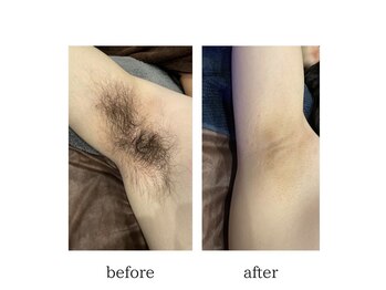 ファブ 青葉店/お客様ビフォーアフター