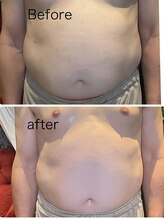 ルミネル 名古屋新栄(Luminelle)/気になるお腹に