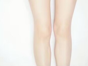 レーヴの写真/清潔感も美しさも叶える、デリケート脱毛