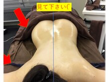 モモン シャルール/ハイパーナイフ＋筋膜クリーム