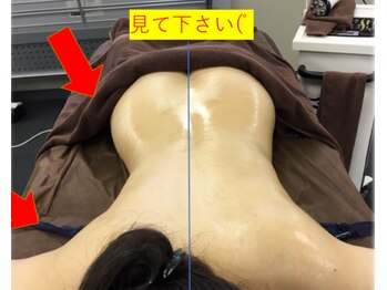 モモン シャルール/ハイパーナイフ＋筋膜クリーム