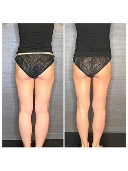 マハロ ザ ビューティー(mahalo the beauty)/痩身