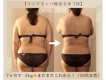 オキシー グレイス 黒崎店(OXY Grace)/インドリンパ痩身全身コース