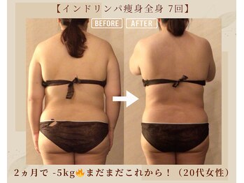オキシー グレイス 黒崎店(OXY Grace)/インドリンパ痩身全身コース