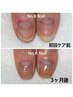 自爪育成 お試し ¥5500
