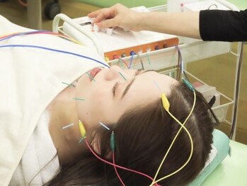 うさぎ鍼灸整骨院の写真/本気で変えたいあなたへ。お顔の左右差/たるみ/毛穴/肌質徹底改善！結果重視の美容鍼【初回限定★1980円】