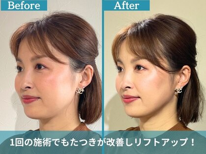 フローフシ∞の写真