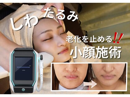 キザシ(kizashi)の写真