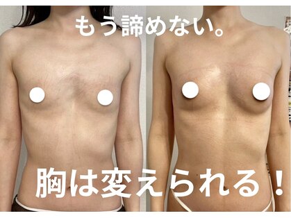 プリマ(prima)の写真