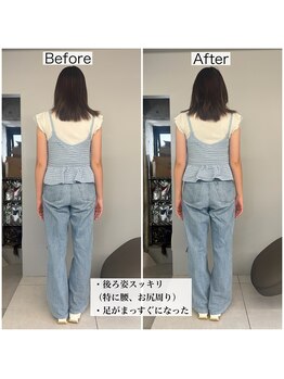 シャウルデッサン(CHARLESDESSIN)/フェムケア矯正