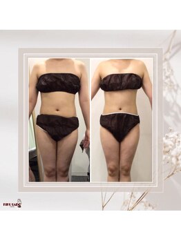 効くラボ 梅田店/1ヶ月でー2キロ