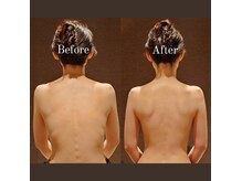 ブライダルエステではビフォーアフター効果に定評があり人気です