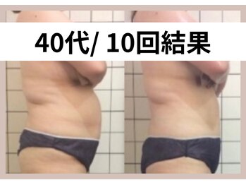 リストアミー(Restore me)/ポッコリお腹もスッキリ♪