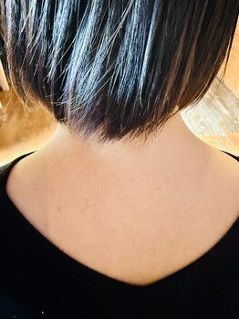 あすから.カイロプラクティック 石芝院/『モヤモヤ血管』が現れています