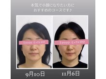 サロン ガト(Salon Gato)の雰囲気（2ヶ月で印象が変わる小顔矯正! 愛らしく艶やかな小顔へ導きます）