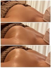 美人バスト 新潟店/ 【バストアップ★育乳】症例