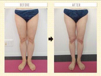 エステアンドトレーニング ビビ(ViVi)/50代　太もも・ふくらはぎ　