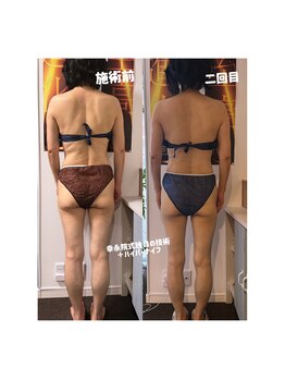 幸永院 川口店の写真/【ハイパーx独自手技】新型ハイパーナ
イフフx進化し続ける独自の根本改善で美しく痩せる＆健康美を実現★