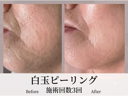 フィオーレ(Fiore)の写真