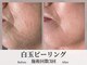 フィオーレ(Fiore)の写真
