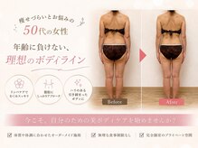 ビドット(Bi.)