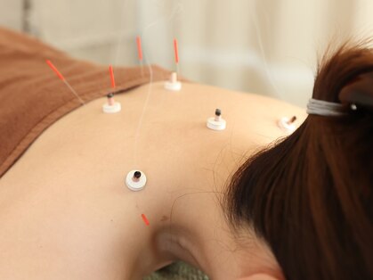 久心宝鍼灸院の写真